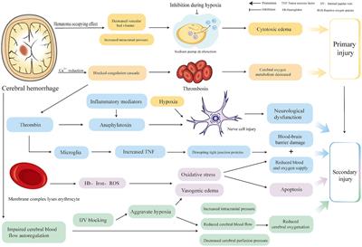 Research progress on high-concentration oxygen therapy after cerebral hemorrhage
